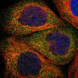 RIPK2 Antibody, Novus Biologicals 0.1mL; Unlabeled:Antibodies, Polyclonal